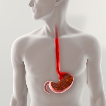 GERD FAQs with Dr. Rishi Sharma: What You Need to Know About Acid Reflux