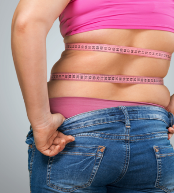 Bariatric Surgery – Is It Right for You?