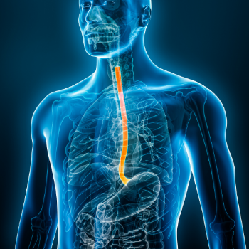 The Importance of Detecting Barrett’s Esophagus Early
