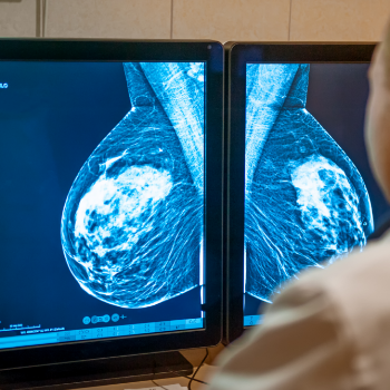 Breast Cancer: Early Warning Signs and Symptoms