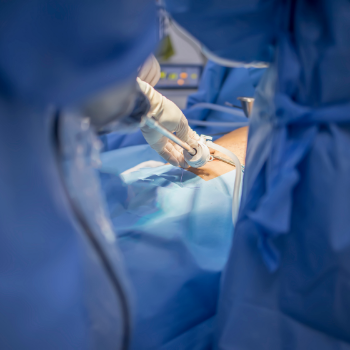 What Is Laparoscopic Gallbladder Surgery and When Is It Needed?