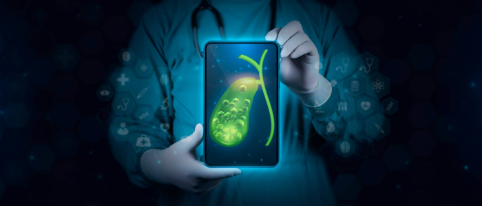 Doctor showing diagram of gallbladder with gallstones