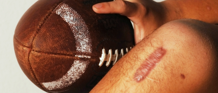 Close-up of a post-surgery knee scar next to a football on the ground, symbolizing recovery from a sports-related knee injury