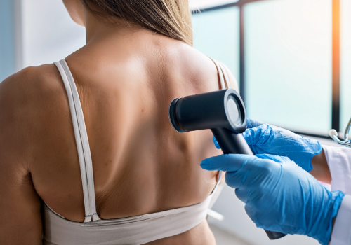Skin Cancer Awareness Month: How to Spot the Signs and Protect Your Skin